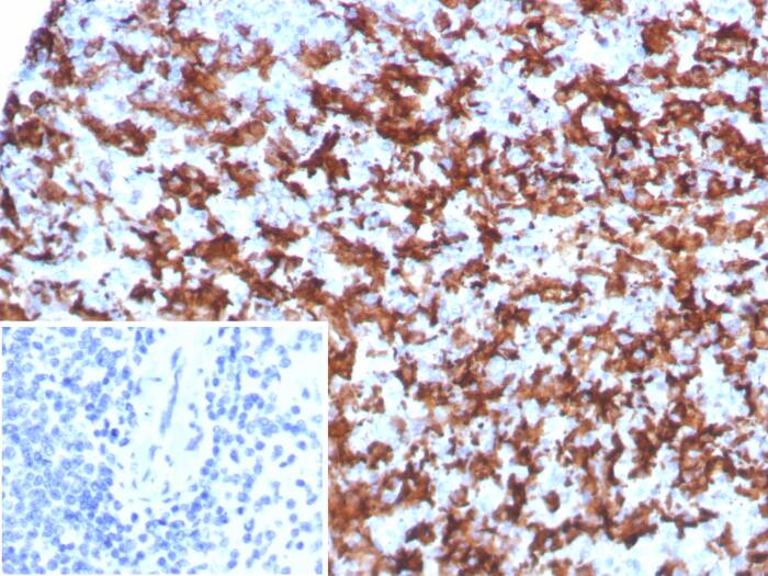 Formalin-fixed, paraffin-embedded human spleen stained with AIF-1/Iba1 antibody (AIF1/8970R). Inset: PBS instead of primary antibody; secondary only negative control.