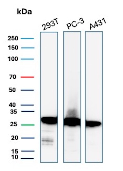 Western blot analysis of 293T, PC-3 and A431 lysates using RPS23 Antibody (YWHAE/8636R). 