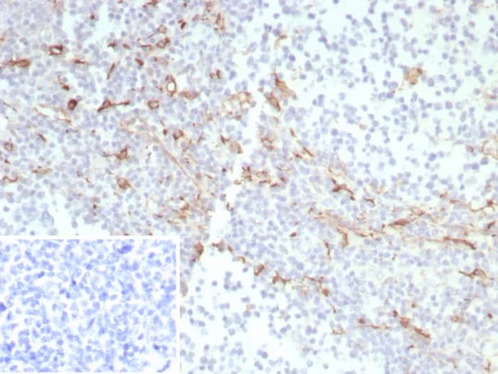 Immunohistochemistry-Paraffin: CD163 Antibody (rM130/8820) [NBP3-23781] - Formalin-fixed, paraffin-embedded human tonsil stained with CD163 Antibody (rM130/8820). Inset: PBS instead of primary antibody; secondary only negative control.