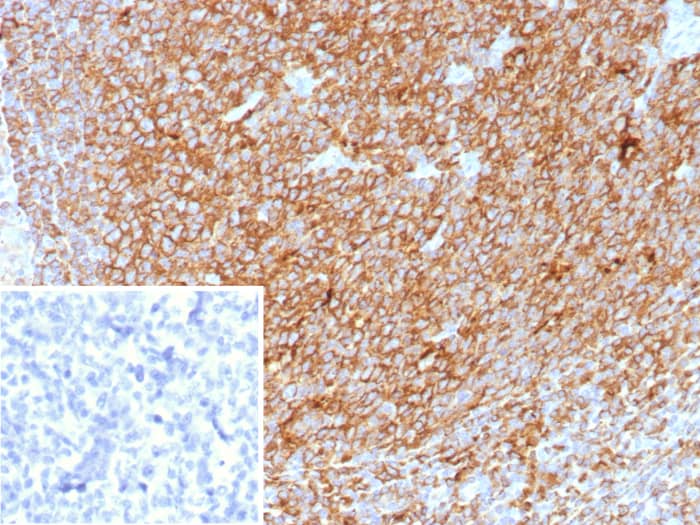 Formalin-fixed, paraffin-embedded human tonsil stained with HLA DQ/DR/DP antibody (HLA-Pan/8622R). Inset: PBS instead of primary antibody; secondary only negative control.