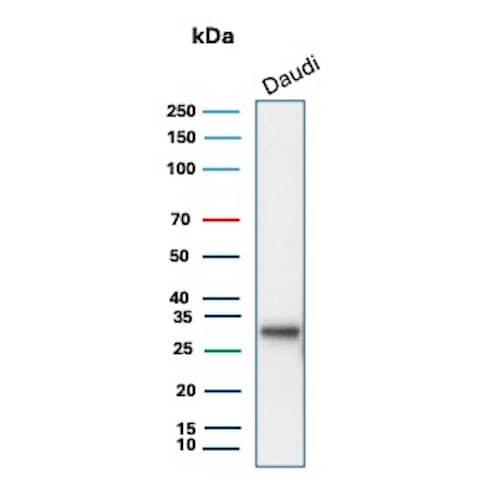 Western Blot Analysis of Daudi cell lysate using HLA DQ/DR/DP Antibody (HLA-Pan/8622R).