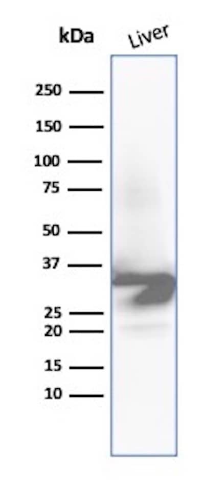 Western Blot Analysis of Human Liver tissue lysate using ICAM-1/CD54 Antibody (ICAM1/9379R).