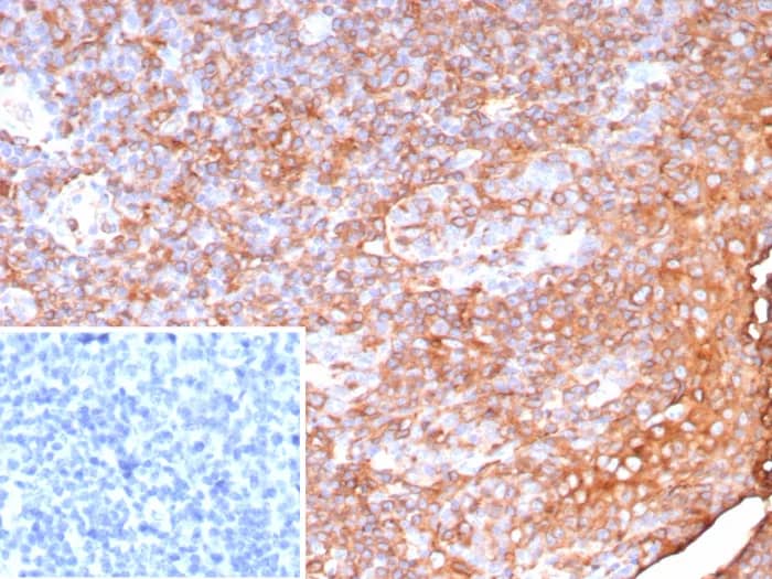 Immunohistochemistry-Paraffin: HLA DQ/DR/DP Antibody (HLA-Pan/9268R) [NBP3-23800] - Formalin-fixed, paraffin-embedded human tonsil stained with HLA DQ/DR/DP Antibody (HLA-Pan/9268R). Inset: PBS instead of primary antibody; secondary only negative control.