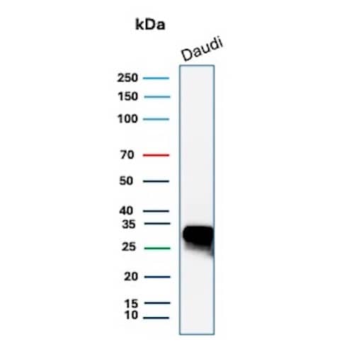 Western blot analysis of  Daudi cell lysate using HLA DQ/DR/DP Antibody (HLA-Pan/9268R).