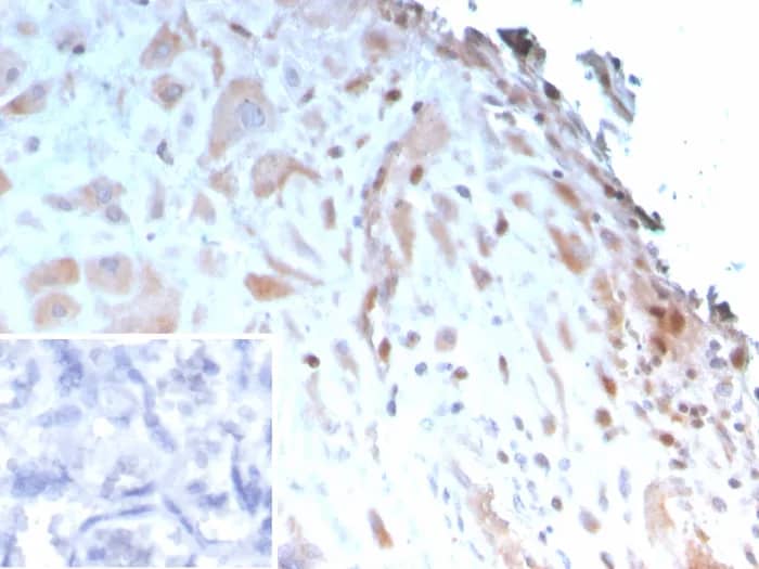 Immunohistochemistry-Paraffin: IGFBP-3 Antibody (IGFBP3/3423) [NBP3-23802] - Formalin-fixed, paraffin-embedded human placenta stained with IGFBP-3 Antibody (IGFBP3/3423). Inset: PBS instead of primary antibody; secondary only negative control.