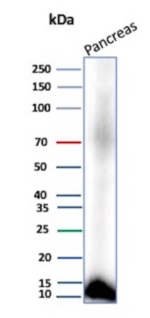Western Blot Analysis of human Pancreas tissue lysate using CLPS Antibody (CLPS/9021).