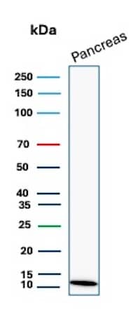 Western Blot Analysis of human Pancreas tissue lysate using CLPS Antibody (CLPS/9021).