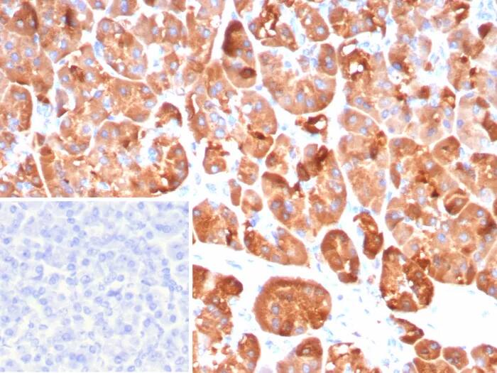 Immunohistochemistry-Paraffin: CLPS Antibody (CLPS/9026) [NBP3-23823] - Formalin-fixed, paraffin-embedded human pancreas stained with CLPS Antibody (CLPS/9026). Inset: PBS instead of primary antibody; secondary only negative control.