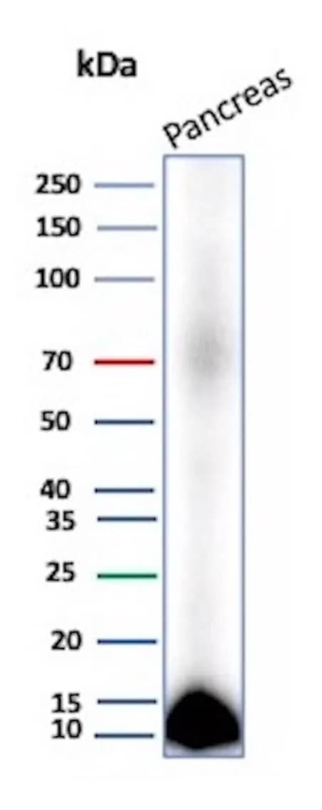 Western Blot Analysis of human Pancreas tissue lysate using CLPS Antibody (CLPS/9026).