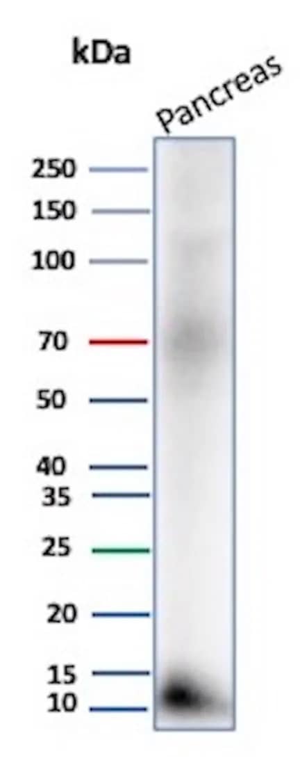 Western Blot Analysis of human Pancreas tissue lysate using CLPS Antibody (CLPS/9027).