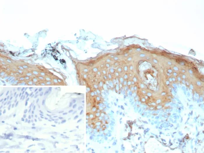 Immunohistochemistry-Paraffin: Involucrin Antibody (rIVRN/9323) [NBP3-23830] - Formalin-fixed, paraffin-embedded human skin stained with Involucrin Antibody (rIVRN/9323). Inset: PBS instead of primary antibody; secondary only negative control.