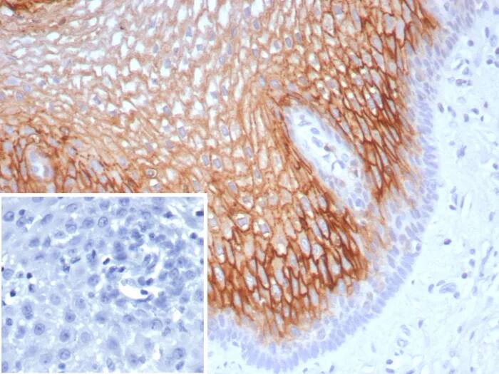 Immunohistochemistry-Paraffin: SBSN Antibody (SBSN/7963) [NBP3-23837] - Formalin-fixed, paraffin-embedded human esophagus stained with SBSN Antibody (SBSN/7963). Inset: PBS instead of primary antibody; secondary only negative control.