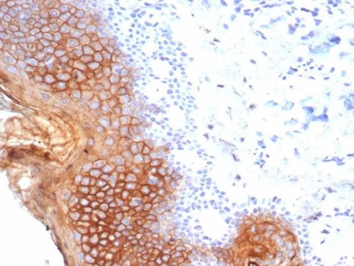 Immunohistochemistry-Paraffin: SBSN Antibody (SBSN/7965) [NBP3-23838] - Formalin-fixed, paraffin-embedded human esophagus stained with SBSN Antibody (SBSN/7965). HIER: Tris/EDTA, pH9.0, 45min. 2°C: HRP-polymer, 30min. DAB, 5min.