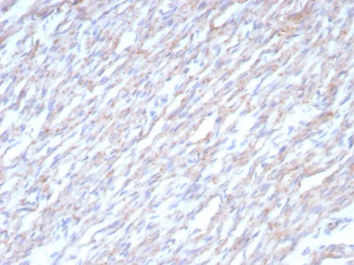 Immunohistochemistry-Paraffin: N-Cadherin Antibody (CDH2/8862R) [NBP3-23845] - Formalin-fixed, paraffin-embedded human heart stained with N-Cadherin Antibody (CDH2/8862R). HIER: Tris/EDTA, pH9.0, 45min. 2°C: HRP-polymer, 30min. DAB, 5min.