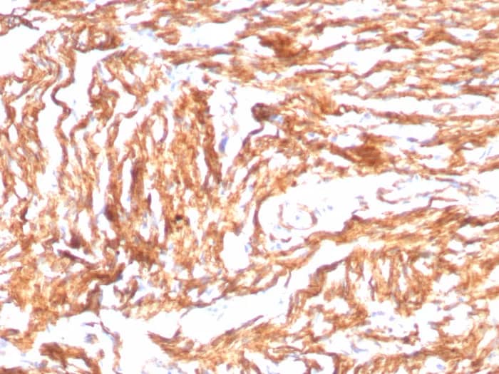Immunohistochemistry-Paraffin: N-Cadherin Antibody (CDH2/8998R) [NBP3-23846] - Formalin-fixed, paraffin-embedded human heart stained with N-Cadherin Antibody (CDH2/8998R). HIER: Tris/EDTA, pH9.0, 45min. 2°C: HRP-polymer, 30min. DAB, 5min.