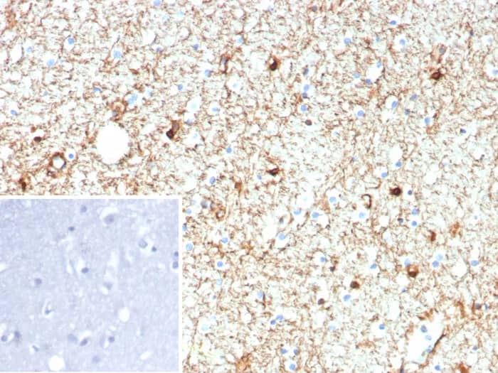 Immunohistochemistry-Paraffin: GFAP Antibody (rGFAP/9150) [NBP3-23853] - Formalin-fixed, paraffin-embedded human brain stained with GFAP Antibody (rGFAP/9150). Inset: PBS instead of primary antibody; secondary only negative control.