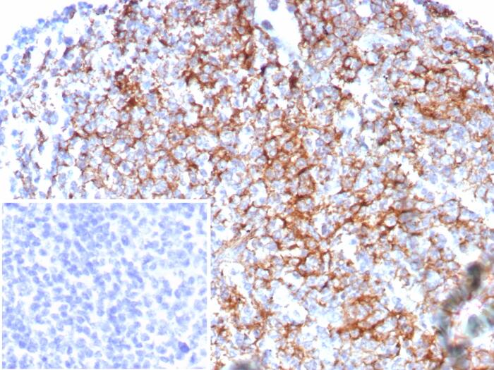 Formalin-fixed, paraffin-embedded human tonsil stained with CD35 antibody (rCR1/8596). Inset: PBS instead of primary antibody; secondary only negative control.