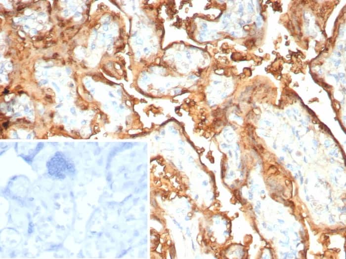 Immunohistochemistry-Paraffin: S100P Antibody (rS100P/9254) [NBP3-23857] - Formalin-fixed, paraffin-embedded human placenta stained with S100P Antibody (rS100P/9254).  Inset: PBS instead of primary antibody; secondary only negative control.
