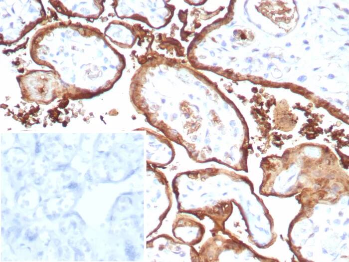 Immunohistochemistry-Paraffin: S100P Antibody (S100P/9135R) [NBP3-23858] - Formalin-fixed, paraffin-embedded human placenta stained with S100P Antibody (S100P/9135R).  Inset: PBS instead of primary antibody; secondary only negative control.