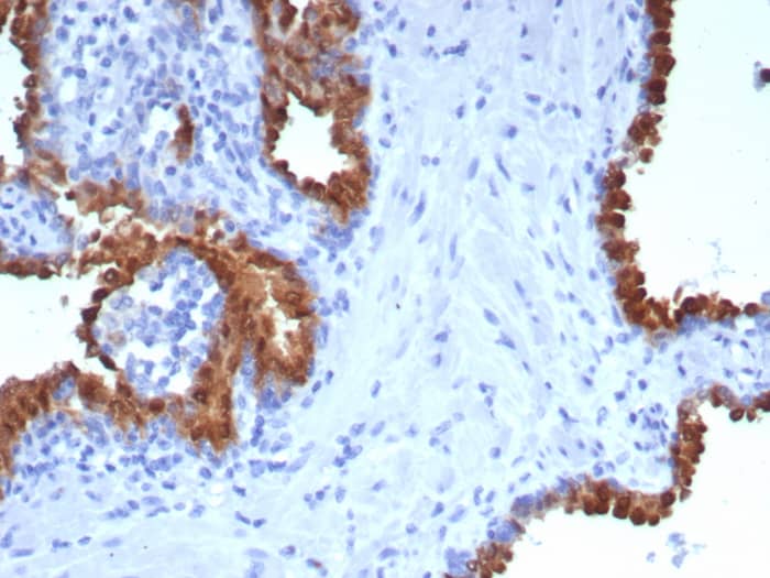 Formalin-fixed, paraffin-embedded human prostate stained with PTP pi/PTPRU antibody (PTPRU/7616). HIER: Tris/EDTA, pH9.0, 45min. Secondary: HRP-polymer, 30min. DAB, 5min.