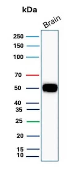 Western Blot Analysis of human brain tissue lysate using GFAP Antibody (GFAP/8615R).