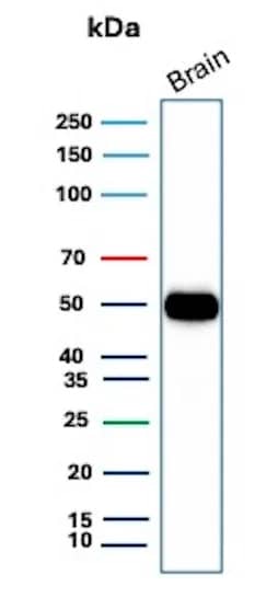 Western Blot Analysis of human brain tissue lysate using GFAP Antibody (GFAP/8616R).