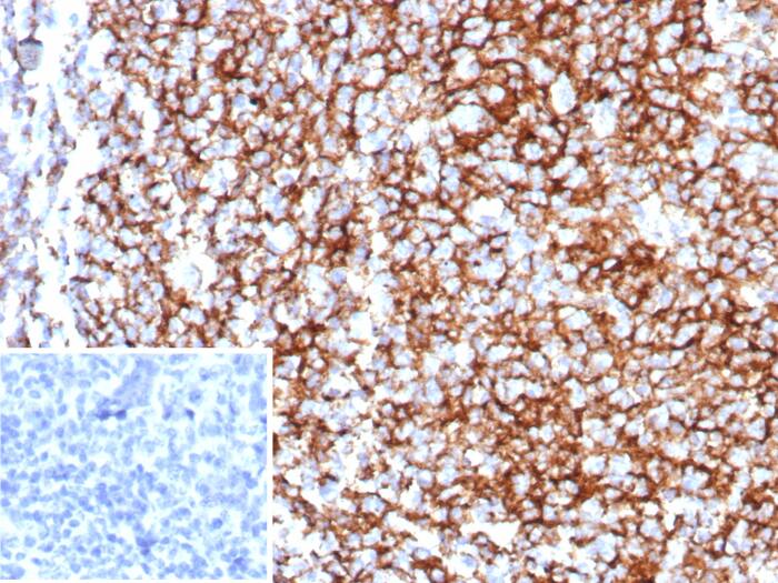 Formalin-fixed, paraffin-embedded human tonsil stained with CD35 antibody (rCR1/8597). Inset: PBS instead of primary antibody; secondary only negative control.