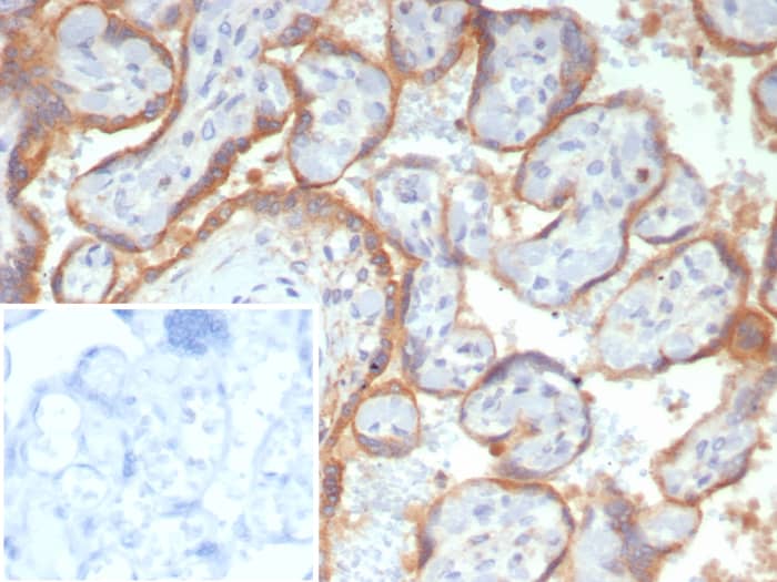 Formalin-fixed, paraffin-embedded human placenta stained with Glypican 3 antibody (GPC3/7991R). Inset: PBS instead of primary antibody; secondary only negative control.