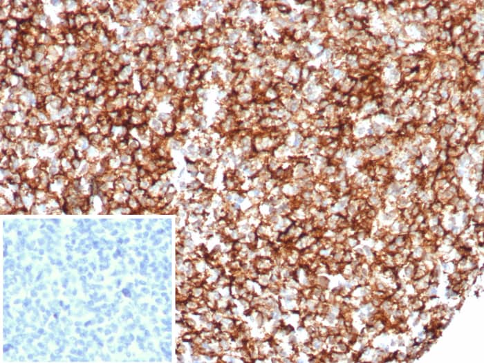 Formalin-fixed, paraffin-embedded human tonsil stained with CD35 antibody (rCR1/8600). Inset: PBS instead of primary antibody; secondary only negative control.