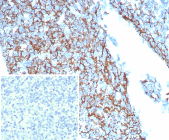 Formalin-fixed, paraffin-embedded human tonsil stained with CD35 antibody (CR1/8244R). Inset: PBS instead of primary antibody; secondary only negative control.
