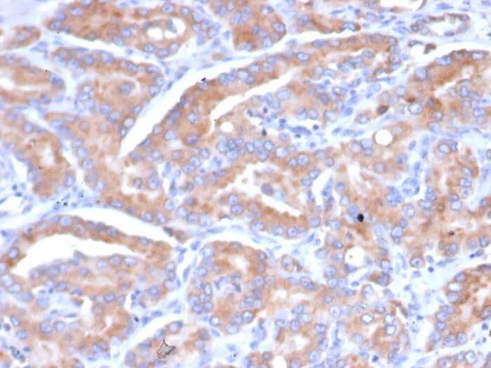 Immunohistochemistry-Paraffin CHID1 Antibody (CHID1/6368)