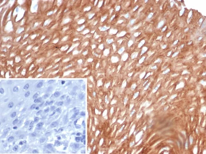 Immunohistochemistry-Paraffin: CHID1 Antibody (CHID1/6368) [NBP3-23888] - Formalin-fixed, paraffin-embedded human esophagus stained with CHID1 Antibody (CHID1/6368) Inset: PBS instead of primary antibody; secondary only negative control.