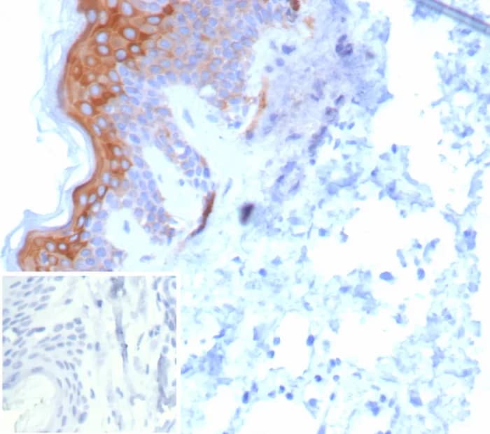 Immunohistochemistry-Paraffin: Cytokeratin 6 Antibody (KRT6/8267R) [NBP3-23895] - Formalin-fixed, paraffin-embedded human skin stained with Cytokeratin 6 Antibody (KRT6/8267R). Inset: PBS instead of primary antibody; secondary only negative control.