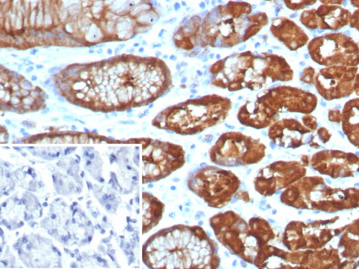 Formalin-fixed, paraffin-embedded human brain stained with Glutamine Synthetase antibody (GLUL/8256R). Inset: PBS instead of primary antibody; secondary only negative control.