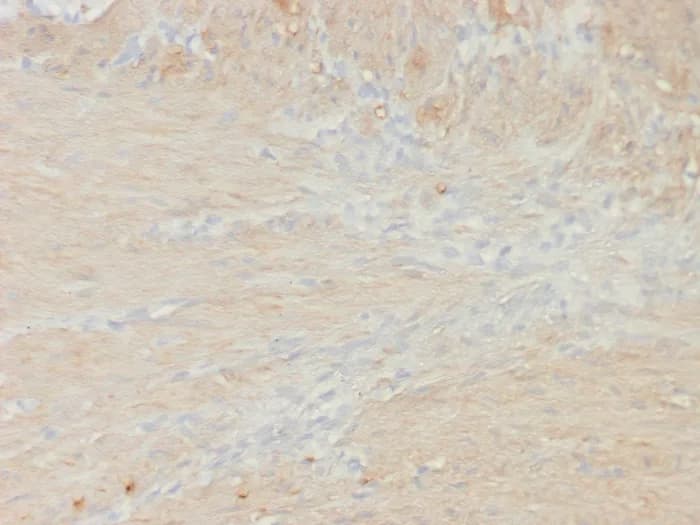 Immunohistochemistry-Paraffin: Myosin heavy chain 11 Antibody (rMYH11/8066) [NBP3-23911] - Formalin-fixed, paraffin-embedded colon smooth muscle stained with Myosin heavy chain 11 Antibody (rMYH11/8066). HIER: Tris/EDTA, pH9.0, 45min. 2°C: HRP-polymer, 30min. DAB, 5min.
