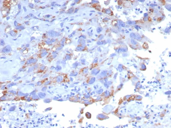 Immunohistochemistry-Paraffin: GPRC5A/RAI3 Antibody (GPRC5A/7893) [NBP3-23915] - Formalin-fixed, paraffin-embedded human bladder stained with GPRC5A/RAI3 Antibody (GPRC5A/7893). HIER: Tris/EDTA, pH9.0, 45min. 2°C: HRP-polymer, 30min. DAB, 5min.