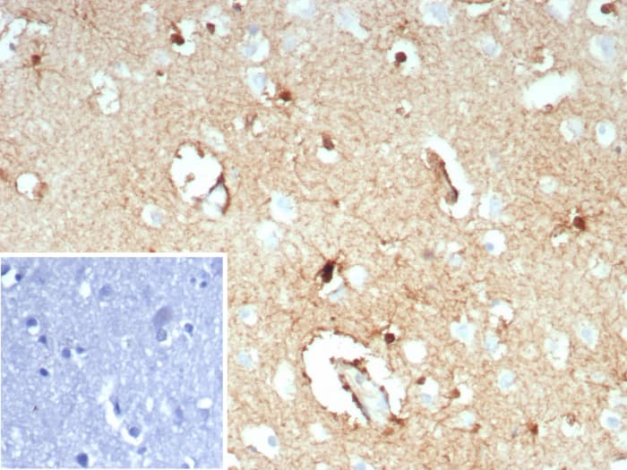 Formalin-fixed, paraffin-embedded human brain stained with Glutamine Synthetase antibody (GLUL/8619R). HIER: Tris/EDTA, pH9.0, 45min. Secondary: HRP-polymer, 30min. DAB, 5min.