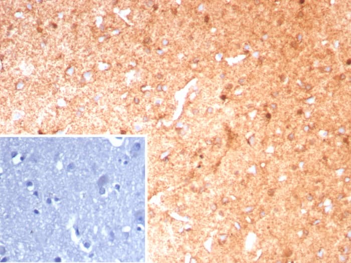 Formalin-fixed, paraffin-embedded human brain stained with Glutamine Synthetase antibody (GLUL/8889R). Inset: PBS instead of primary antibody; secondary only negative control.