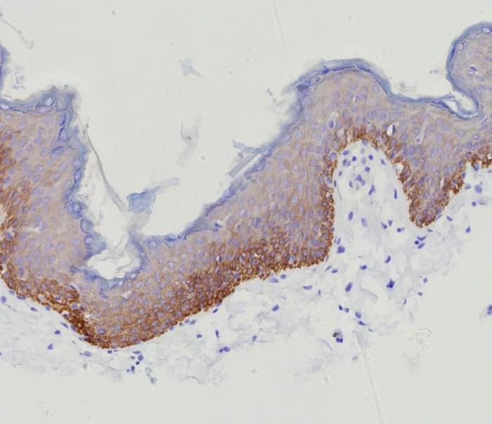 Immunohistochemistry-Paraffin: Cytokeratin 15 Antibody (KRT15/9088R) [NBP3-23919] - Formalin-fixed, paraffin-embedded human skin stained with Cytokeratin 15 Antibody (KRT15/9088R). HIER: Tris/EDTA, pH9.0, 45min. 2°C: HRP-polymer, 30min. DAB, 5min.