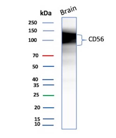 Western blot analysis of Human Brain tissue lysates using NCAM-1/CD56 Antibody (NCAM1/9074R).