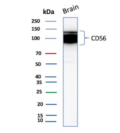 Western blot analysis of Human Brain tissue lysates using NCAM-1/CD56 Antibody (NCAM1/9121R).