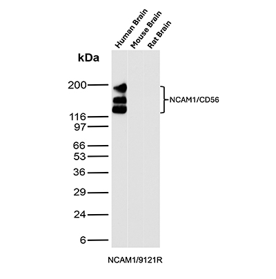 Western blot analysis of Human Brain, Mouse Brain and Rat Brain tissue lysates using NCAM-1/CD56 Antibody (NCAM1/9121R).