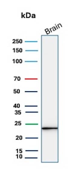 Western Blot Analysis of human brain tissue lysate using UCH-L1/PGP9.5 Antibody (rUCHL1/8057). 