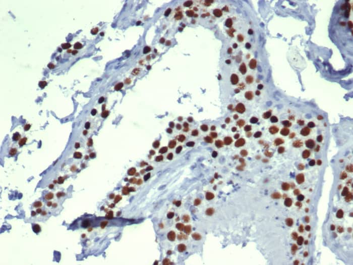 Formalin-fixed, paraffin-embedded human testis stained with MCM3 antibody (MCM3/6706). HIER: Tris/EDTA, pH9.0, 45min. Secondary: HRP-polymer, 30min. DAB, 5min.