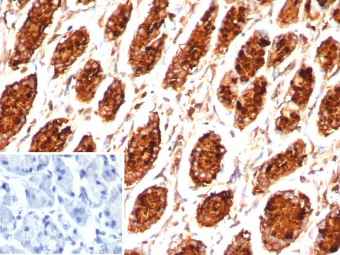 Immunohistochemistry-Paraffin: MUC5AC Antibody (MUC5AC/7798R) [NBP3-23948] - IHC analysis of formalin-fixed, paraffin-embedded human stomach. MUC5AC Antibody (MUC5AC/7798R). Inset: PBS instead of primary antibody; secondary only negative control.