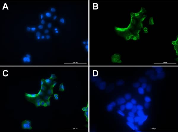 Immunoprecipitation: Glucagon Antibody [NBP3-23954] - Immunofluorescence of Glucagon Antibody. Cell Line: MCF7 cells. Fixative: 100% Methanol. Permeabilization: 0.3% Triton X-100. Primary Antibody: Anti-Glucagon at 15µg/mL overnight at 2-8°C. Secondary Antibody: Goat Anti-Rabbit IgG DyLight™488 at 5µL/mL for 1hr at RT. Nuclear Counterstain: DAPI. Staining: (A). DAPI. (B). Anti-Glucagon + DyLight™488 secondary. (C). Merge A+B. (D). secondary only. Localization expected: Cytoplasm.