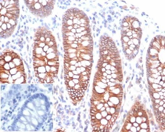 Immunohistochemistry-Paraffin: E-Cadherin Antibody (rCDH1/6769) - Azide and BSA Free [NBP3-23977] - Formalin-fixed, paraffin-embedded human colon stained with E-Cadherin Antibody (rCDH1/6769). Inset: PBS instead of primary antibody; secondary only negative control.