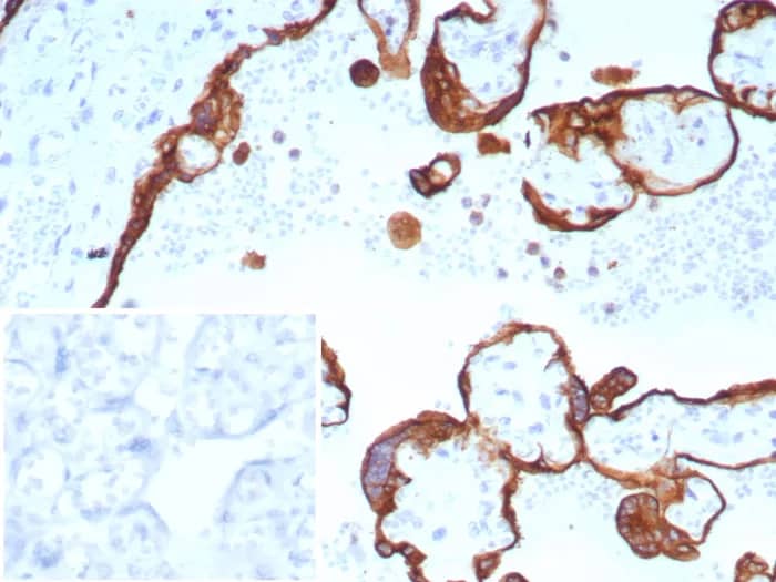 Immunohistochemistry-Paraffin: Cytokeratin, LMW Antibody (rKRTL/8751) - Azide and BSA Free [NBP3-23978] - Formalin-fixed, paraffin-embedded human placenta stained with Cytokeratin, LMW Antibody (rKRTL/8751). Inset: PBS instead of primary antibody; secondary only negative control.