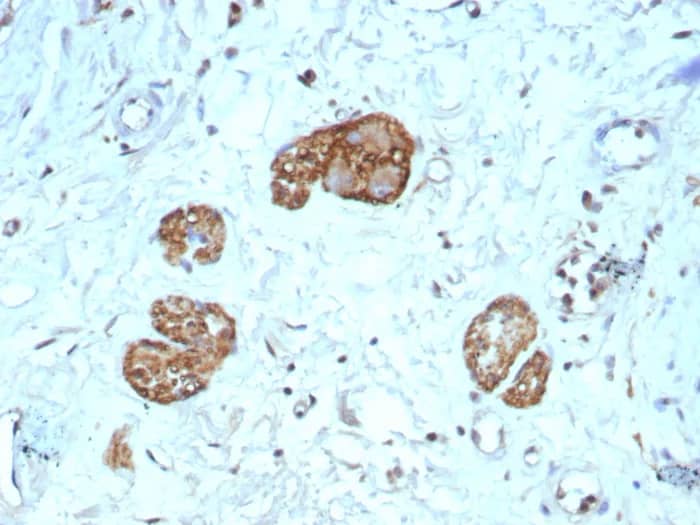 Immunohistochemistry-Paraffin: NCAM-1/CD56 Antibody (NCAM1/9121R) - Azide and BSA Free [NBP3-23979] - Formalin-fixed, paraffin-embedded human colon stained with NCAM-1/CD56 Antibody (NCAM1/9121R). HIER: Tris/EDTA, pH9.0, 45min. 2°C: HRP-polymer, 30min. DAB, 5min.