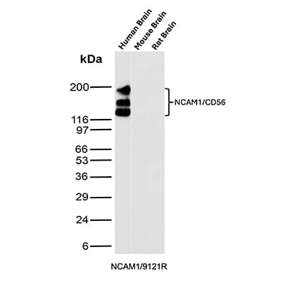 Western blot analysis of Human Brain, Mouse Brain and Rat Brain tissue lysates using NCAM-1/CD56 Antibody (NCAM1/9121R) - Azide and BSA Free.
